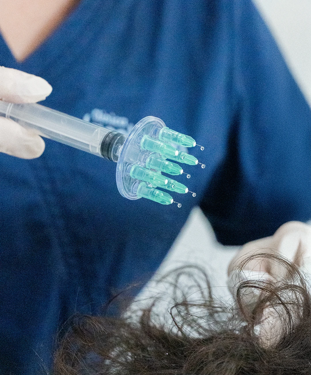 Clinica capilar Barcelona Clinica capilar Barcelona